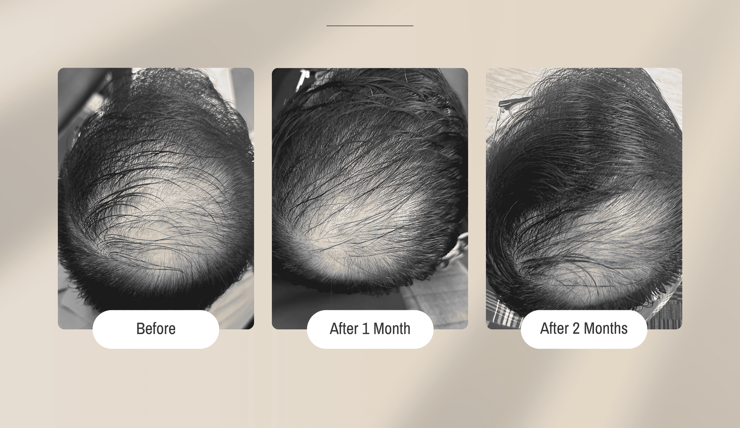 Hair Elixir™ Hair Fall Control Formula - ⁠⁠Formulated in collaboration with Researchers from NUS