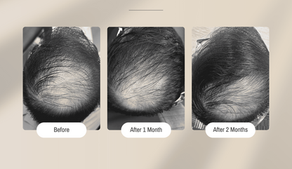Hair Elixir™ Hair Fall Control Formula - ⁠⁠Formulated in collaboration with Researchers from NUS