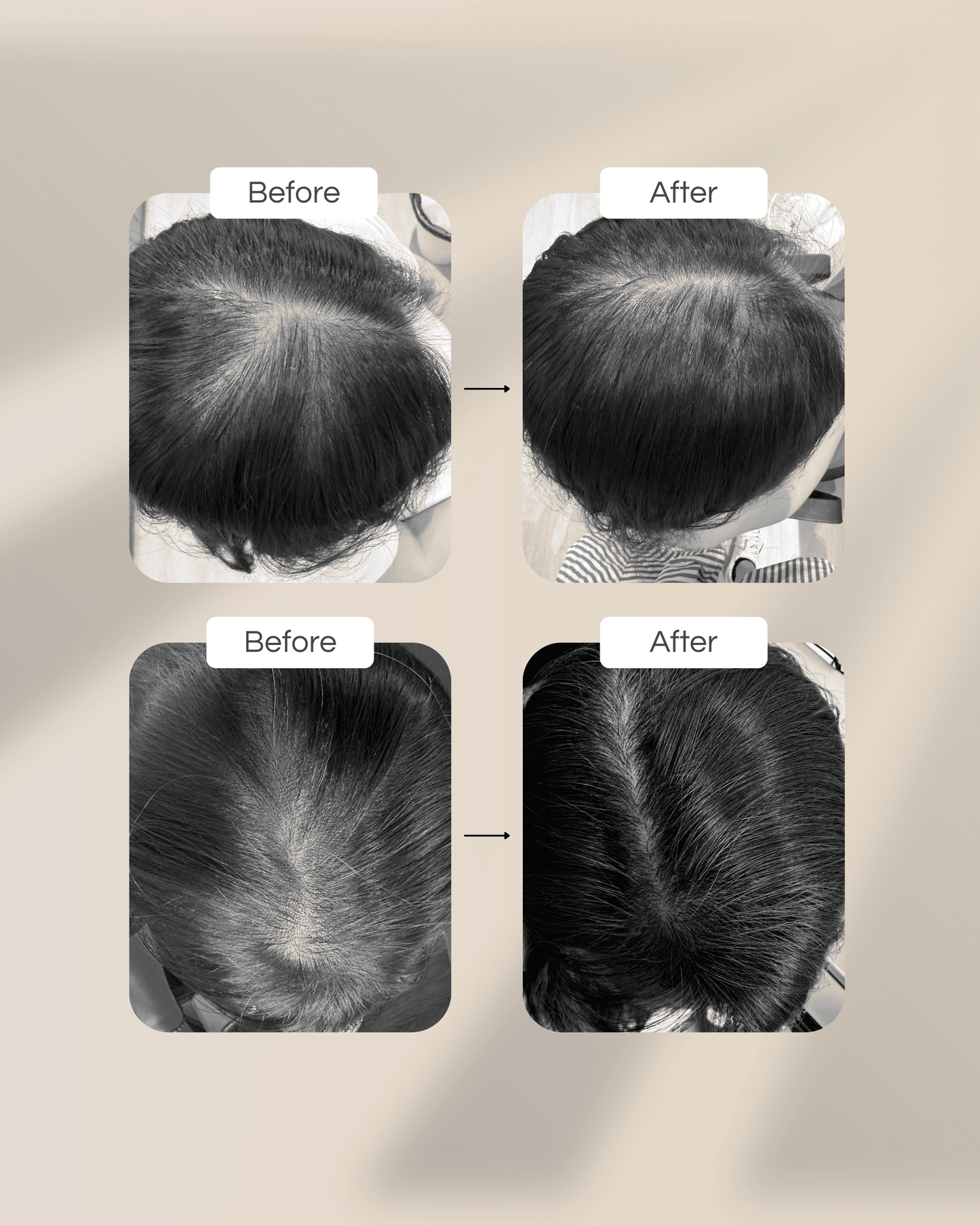 Hair Elixir™ Hair Fall Control Formula - ⁠⁠Formulated in collaboration with Researchers from NUS