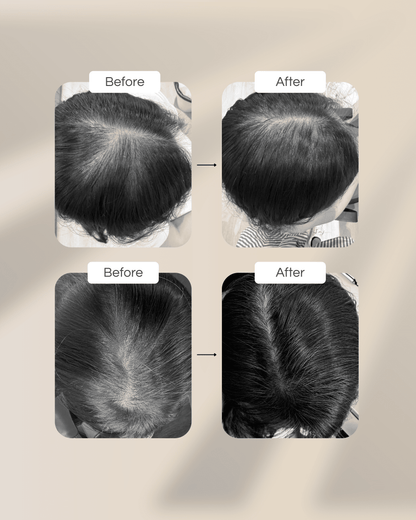 Hair Elixir™ Hair Fall Control Formula - ⁠⁠Formulated in collaboration with Researchers from NUS