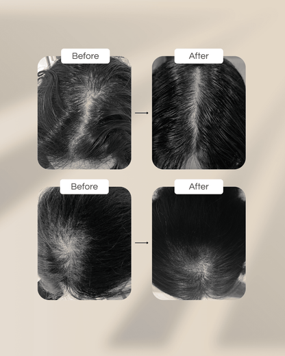 Hair Elixir™ Hair Fall Control Formula - ⁠⁠Formulated in collaboration with Researchers from NUS