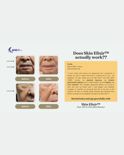 Skin Elixir™ White Tomato (PhytoflORAL®) + NMN - Formulated in collaboration with Professor from NUS